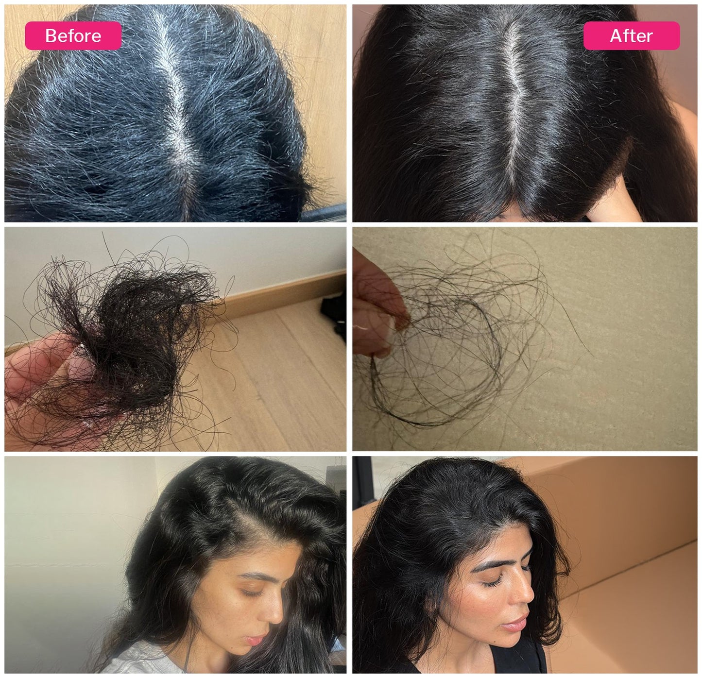 HAIR SCALP BUNDLE